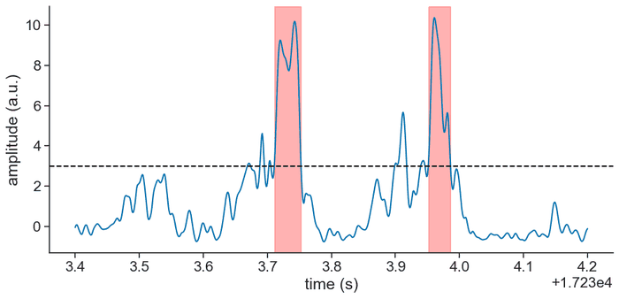 Detecting sharp-wave ripples
