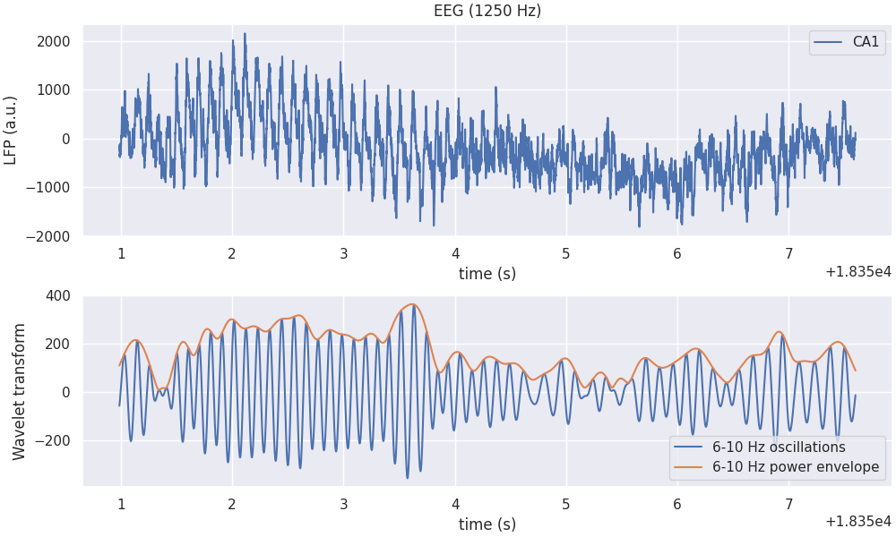 EEG (1250 Hz)