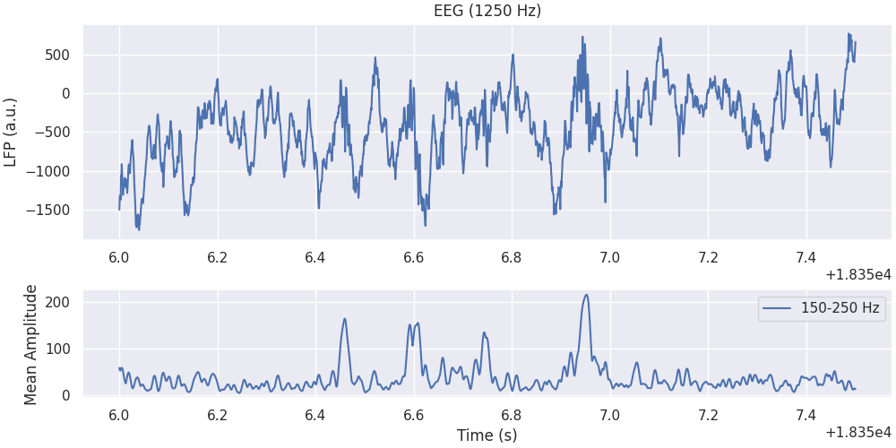 EEG (1250 Hz)