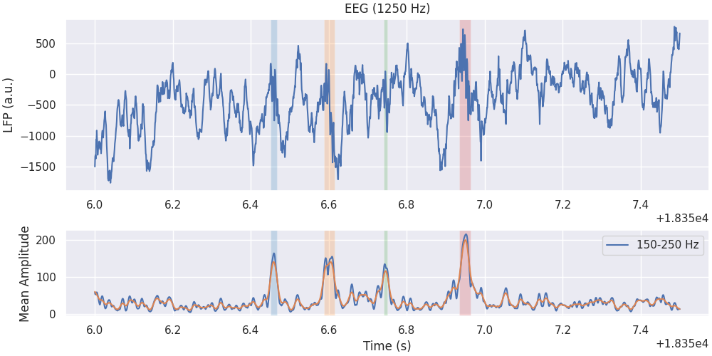 EEG (1250 Hz)